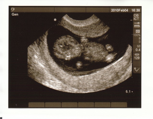 Sonogram1.jpg
