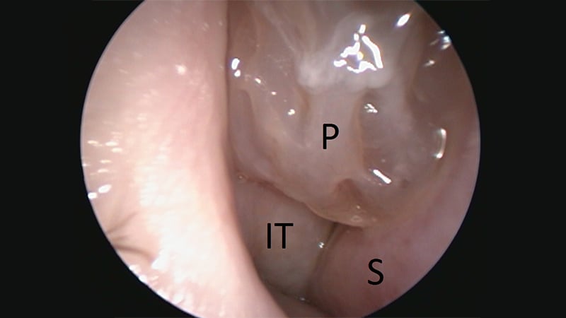reference.medscape.com